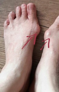 Kaki sy yg berbonggol ni mmg x cantik.. Kaki org kerja berat he he.. Sejak kecil sy dapat merasakan signal dri bonggol ni kalau ada musibah buruk yg nak dtg..